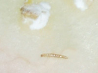 Baby Morio Worm
